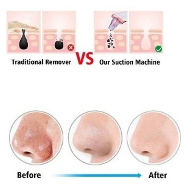 Συσκευή Καθαρισμού Προσώπου από Μαύρα Στίγματα Andowl Q-M300