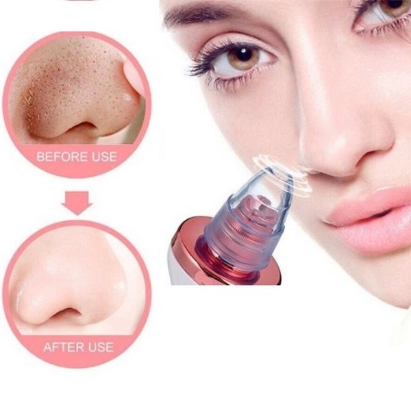 Συσκευή Καθαρισμού Προσώπου Επαναφορτιζόμενη Για Πόρους Και Μαύρα Στίγματα Q-M301